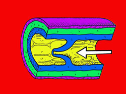 Filament de Casley